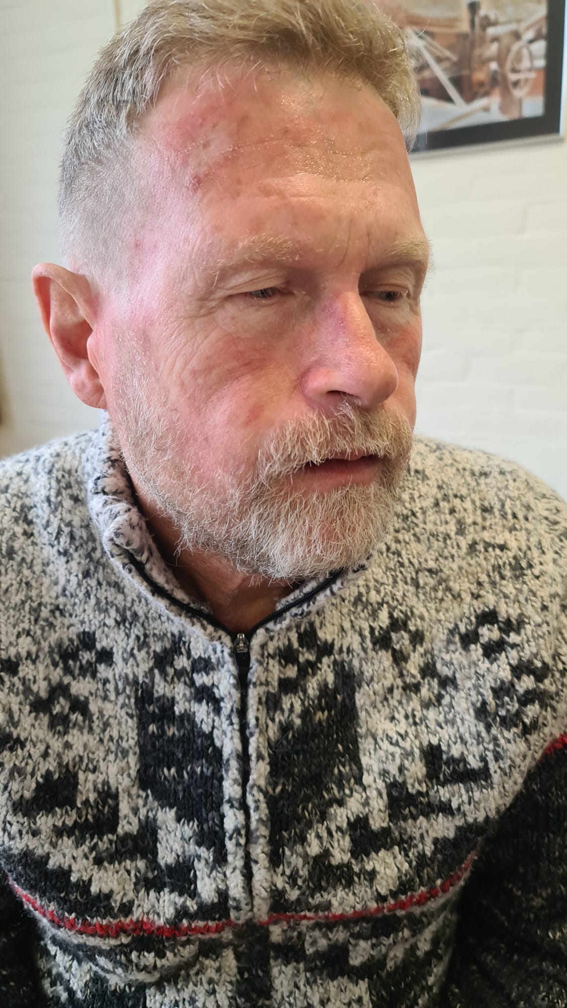 Trauma-acteur Hans Steeman op locatie